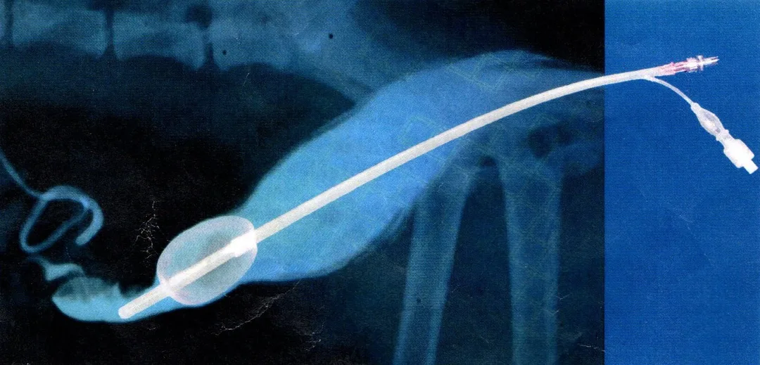 CVI Mavic AI catheter