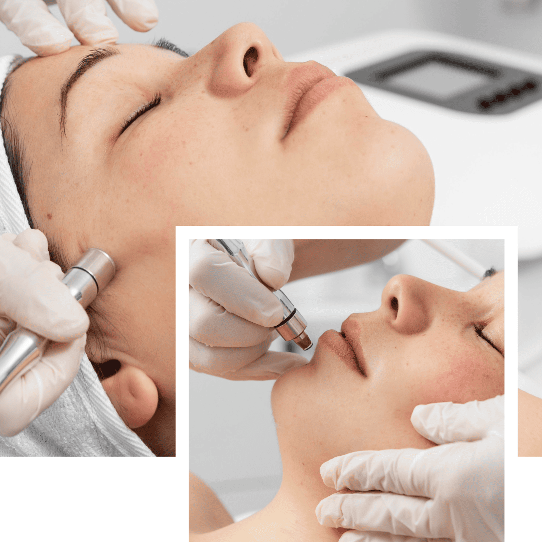 Mikrodermabrasion - Diamant Gesichtspflege DIY für Zuhause