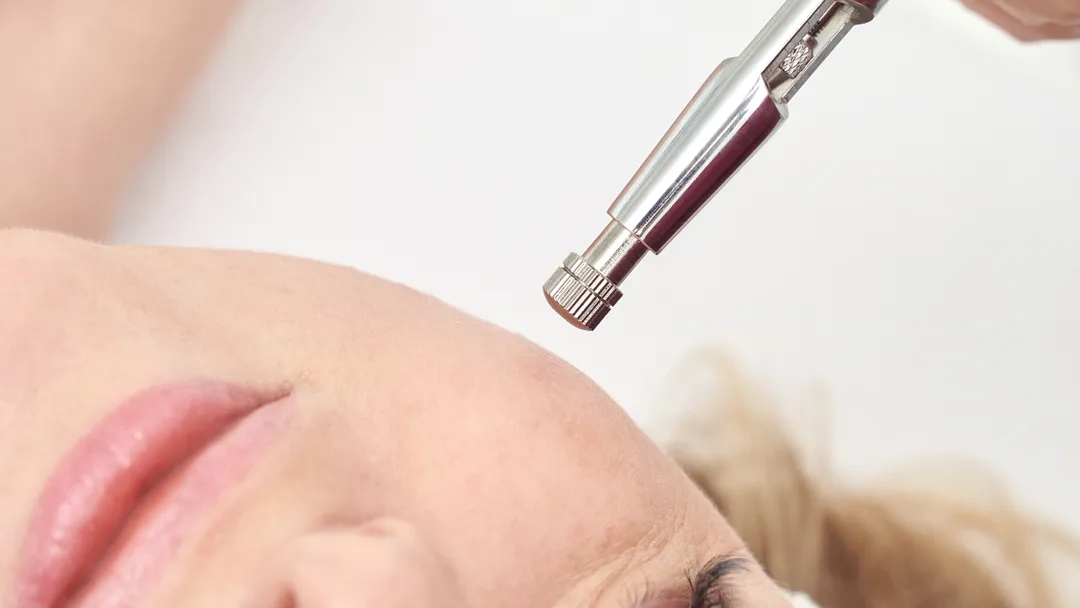 Mikrodermabrasion Gerät 
