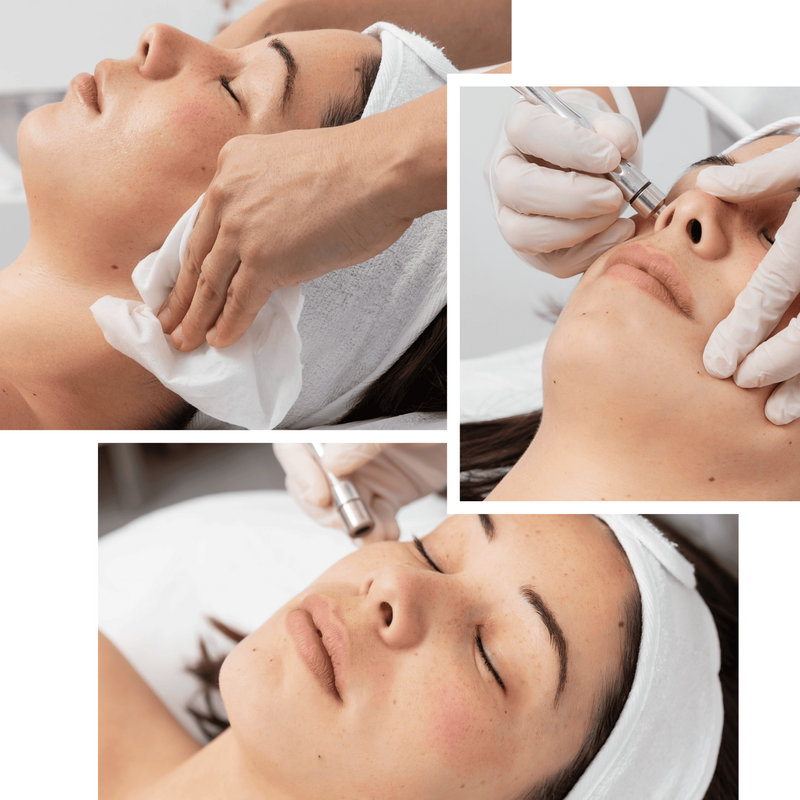 Mikrodermabrasion - verschiedene Blickwinkel