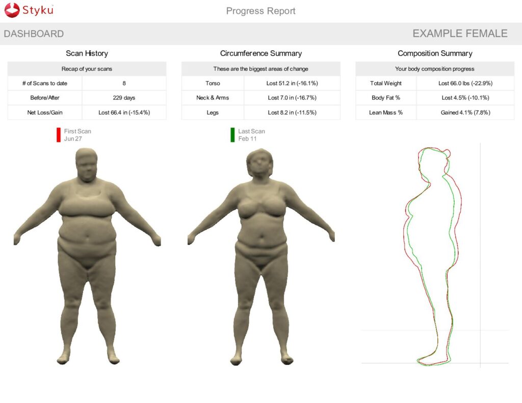 Styku Body Scan Report  at Functional Medicine Plus Toledo OH