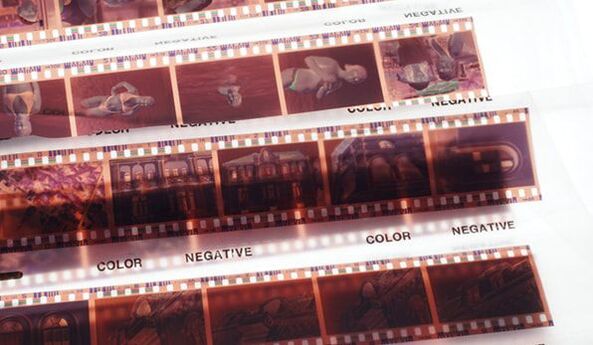 Negative Scanning​