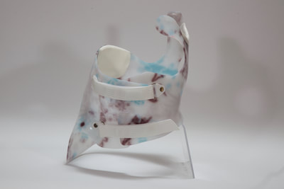 scoliosis brace Gensingen, Advanced Orthodynamics