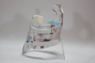 Scoliosis Brace