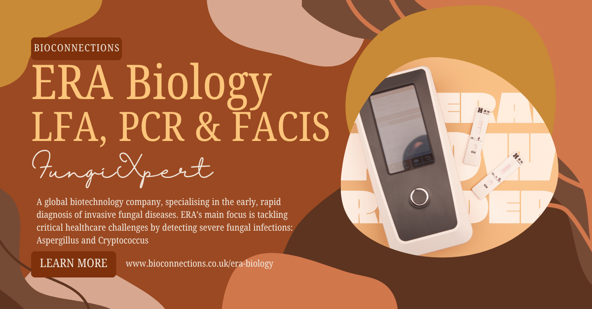 ERA Biology: Lateral flow assays, Real-time PCR and a FACIS machine, how exciting