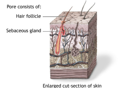 What causes acne and how does a zit form under the skin, learn how blackheads turn into breakouts and scientific information on acne 