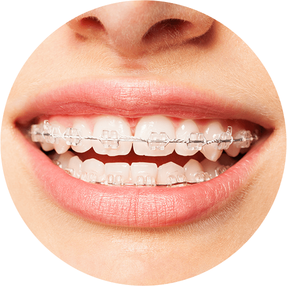 How a root canal procedure is done - Step by step pictorial.