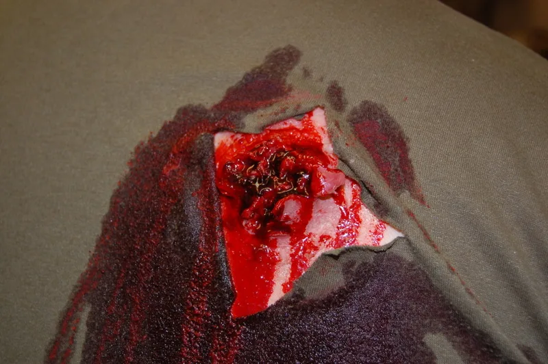 Gunshots & Lacerations