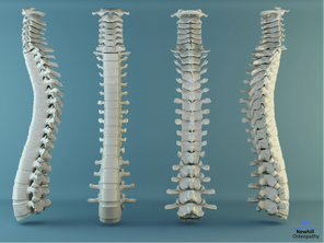 Model of a human Spine to show what Osteopathy works with.
