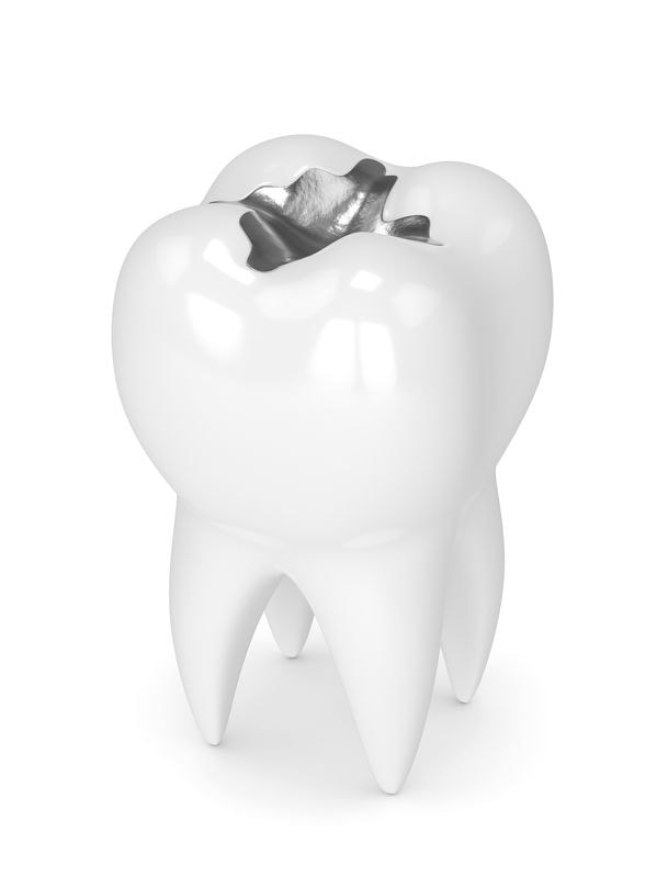 silver-amalgam-filling