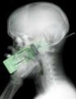EMF Protection
