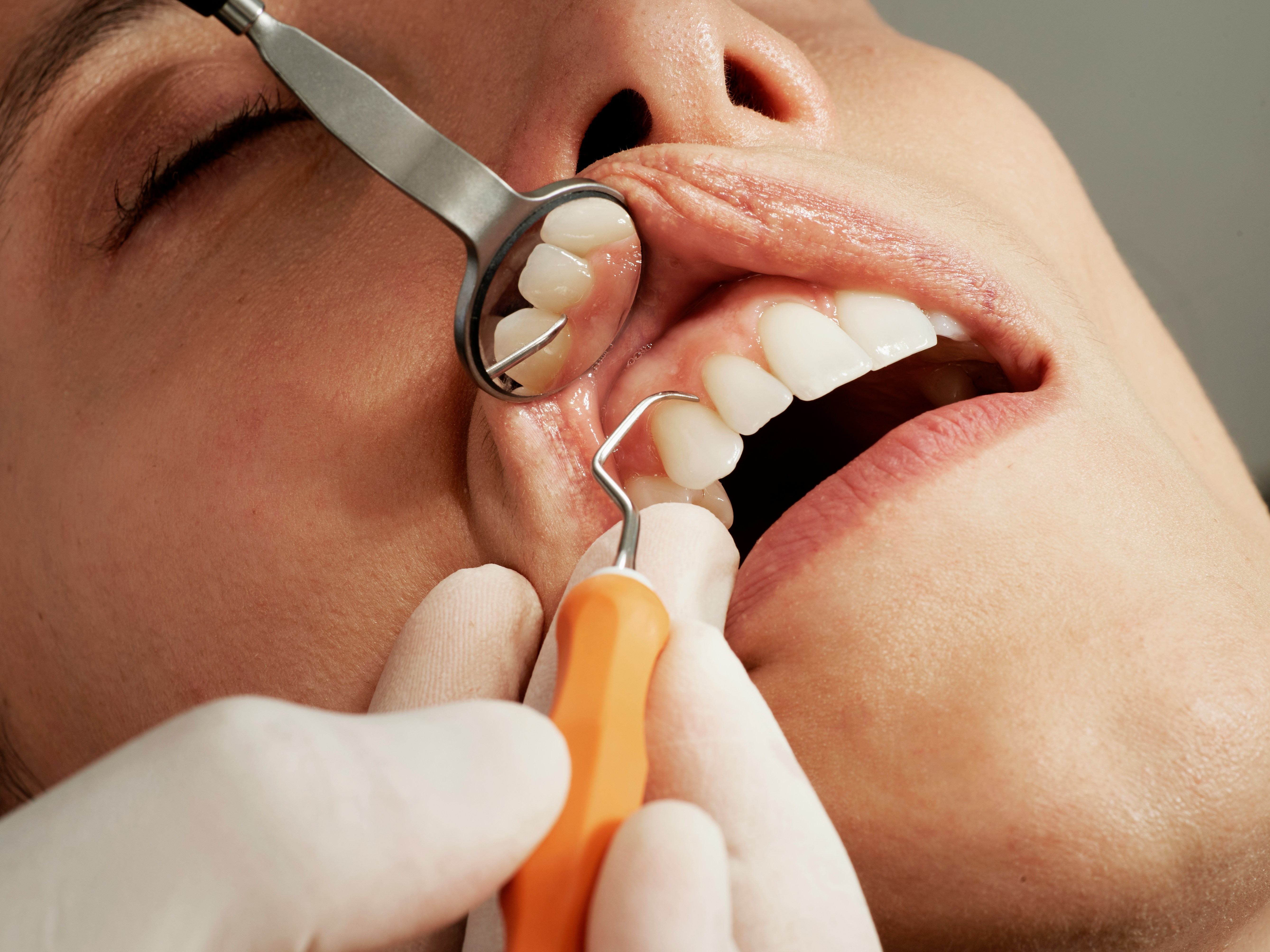 Image description